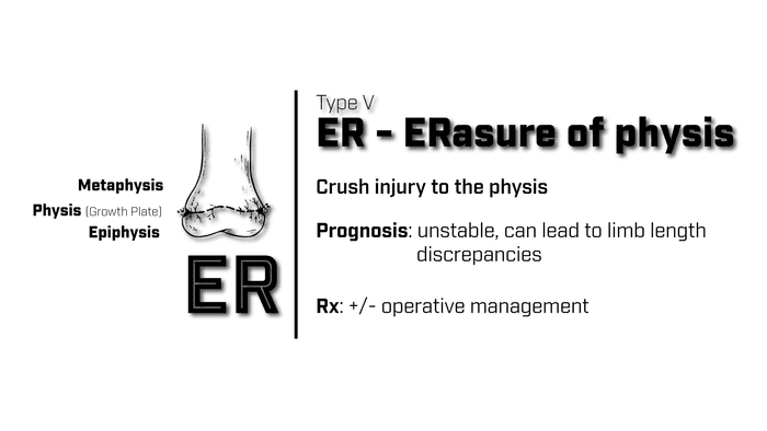 Type 5 Salter Harris Fracture