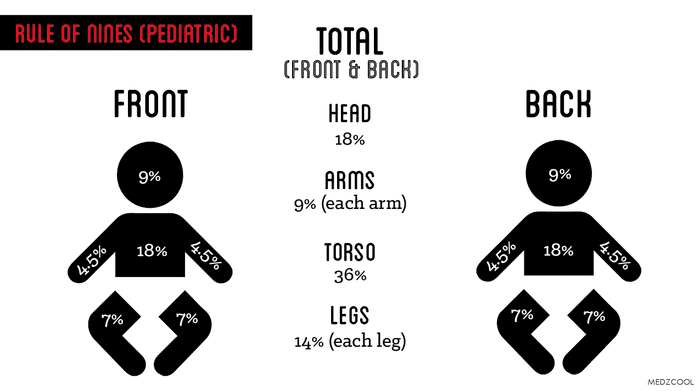 Pediatric Rule of Nines