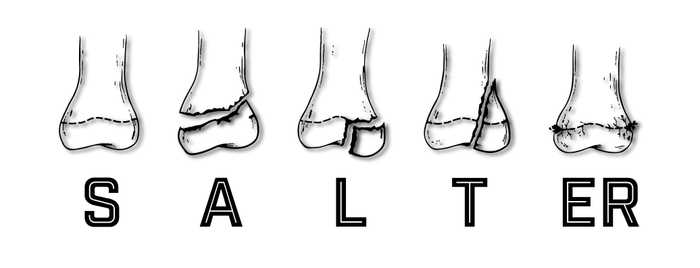 Salter Harris Fractures