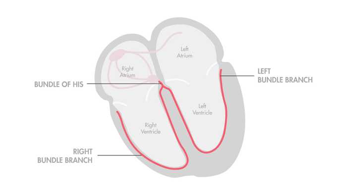 Ventricular Conduction