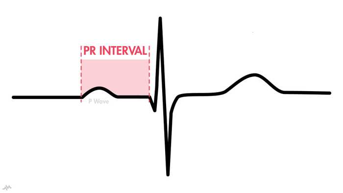 PR Interval