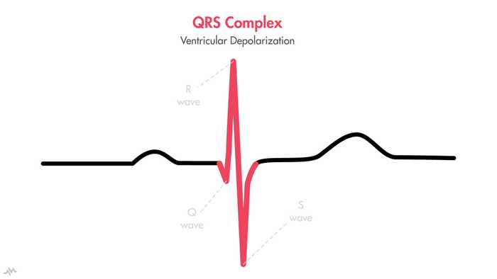 QRS Complex